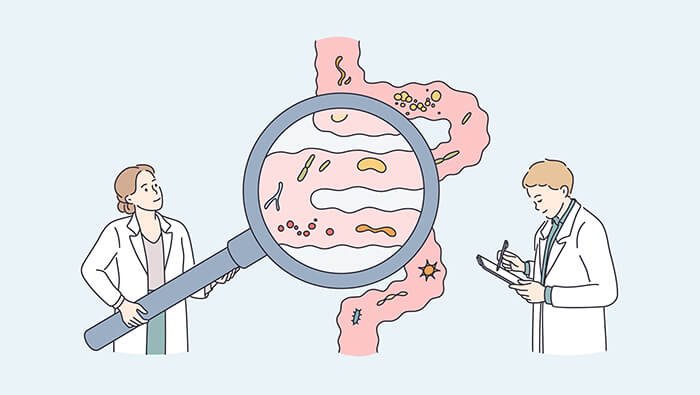 SOBRECRECIMIENTO-BACTERIANO-EN-EL-INTESTINO-DELGADO